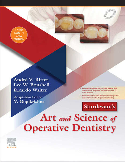 Sturdevant's Art and Science of Operative Dentistry, 3rd South Asian Edition – Your Ultimate Guide to Mastering Operative Dentistry