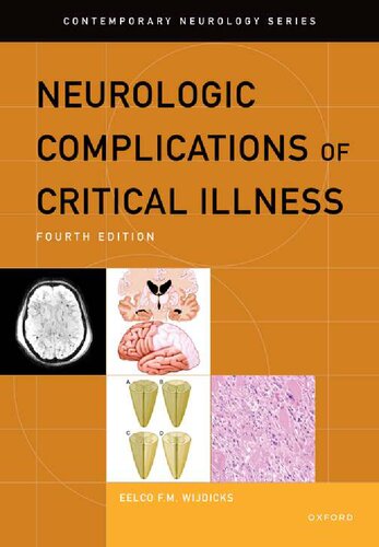 Neurologic Complications of Critical Illness 4th Edition 2023