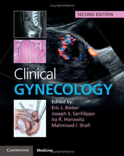 Clinical Gynecology 2nd Edition