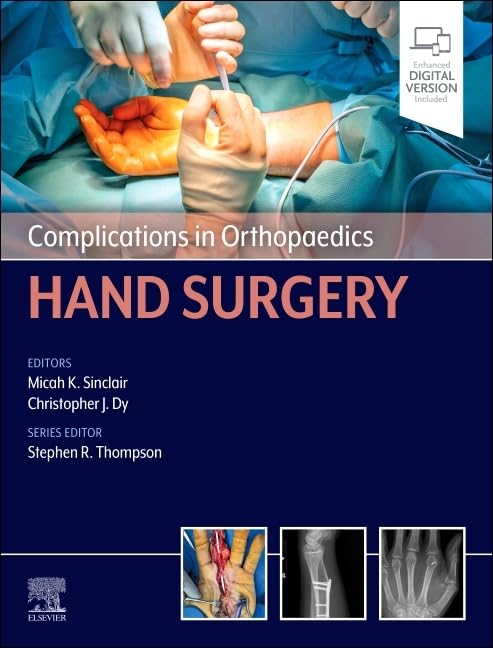 Complications in Orthopaedics Hand Surgery 2026 Premium MultIcolor Matte Print Javed Books
