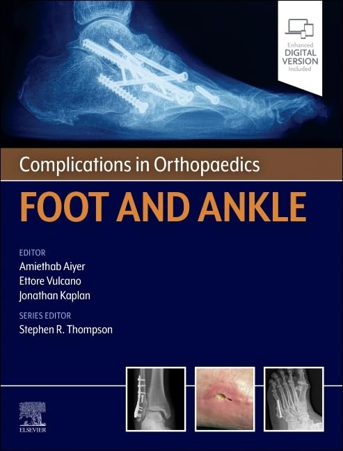 Complications in Orthopaedics: Foot and Ankle by Amiethab Aiyer MD FAOA FAAOS 2026 Edition Multicolor Matte Print Javed Books