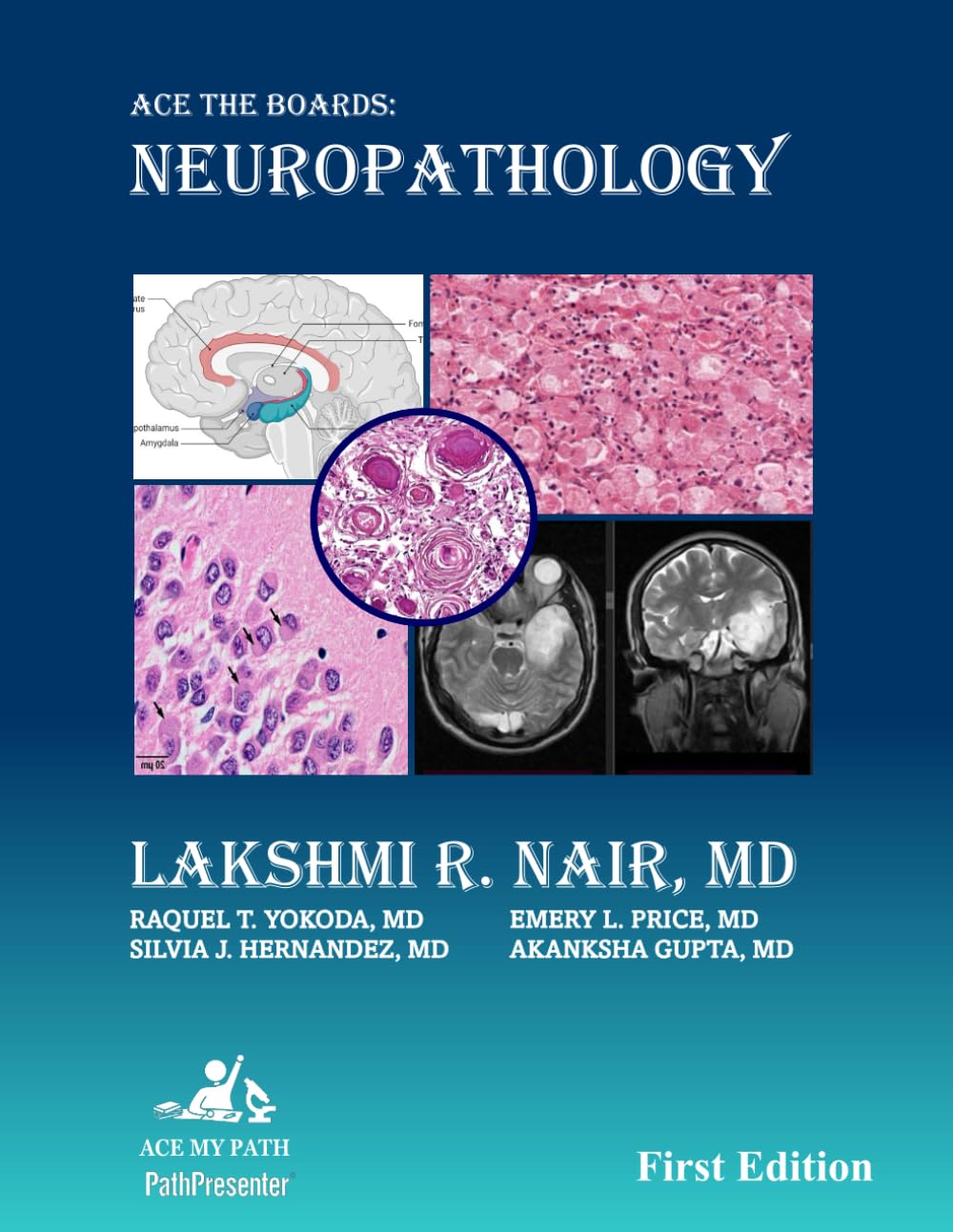 Ace The Boards: Neuropathology Premium Multicolor Matte Print Javed Books