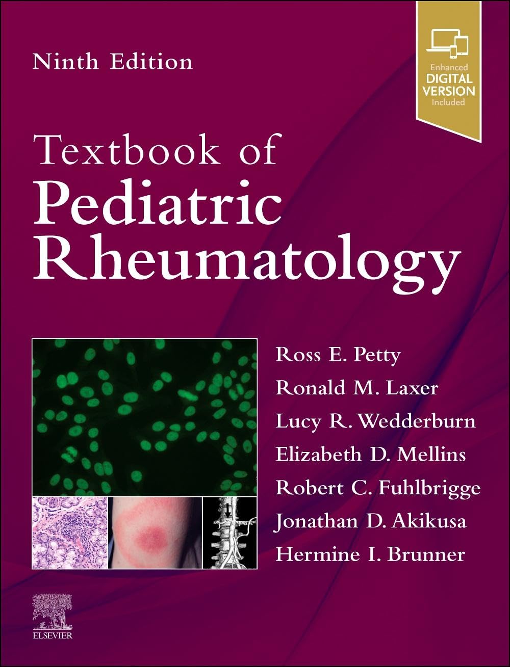 Textbook of Pediatric Rheumatology 2026 Ninth Edition Premium Multicolor Matte Print Javed Books