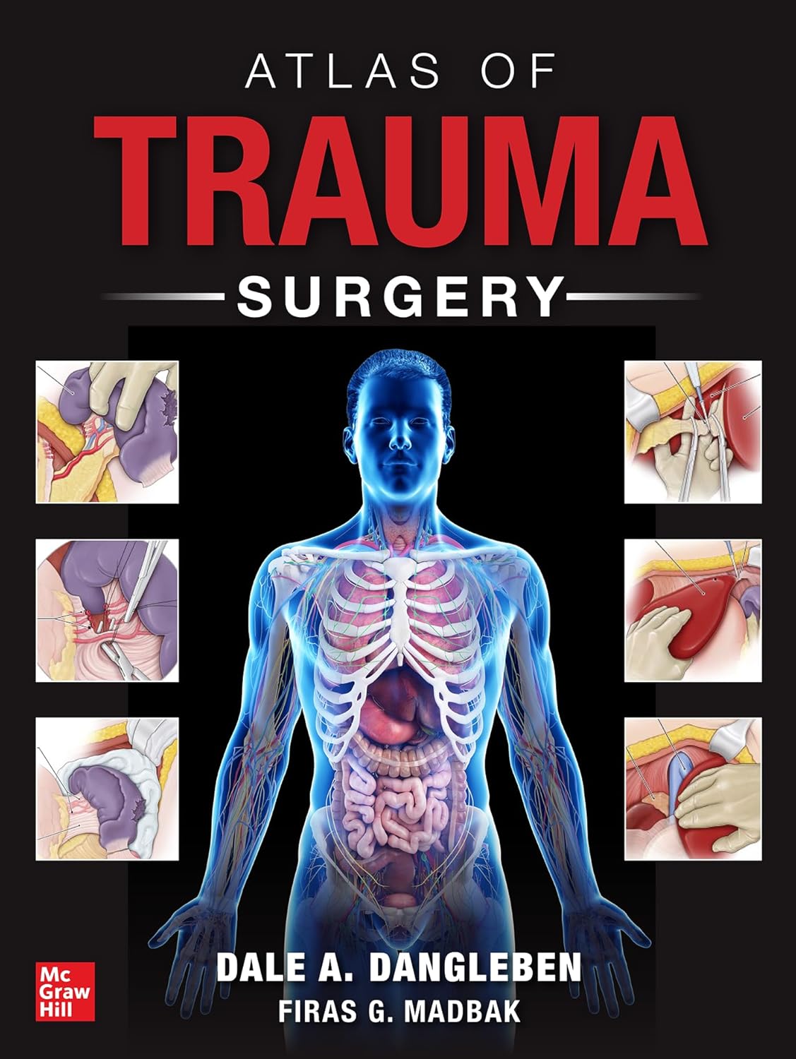 Atlas of Trauma Surgery 2026 Premium Multicolor Matte Print Javed Books