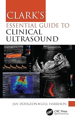 Clark's Essential Guide to Clinical Ultrasound 1st Edition