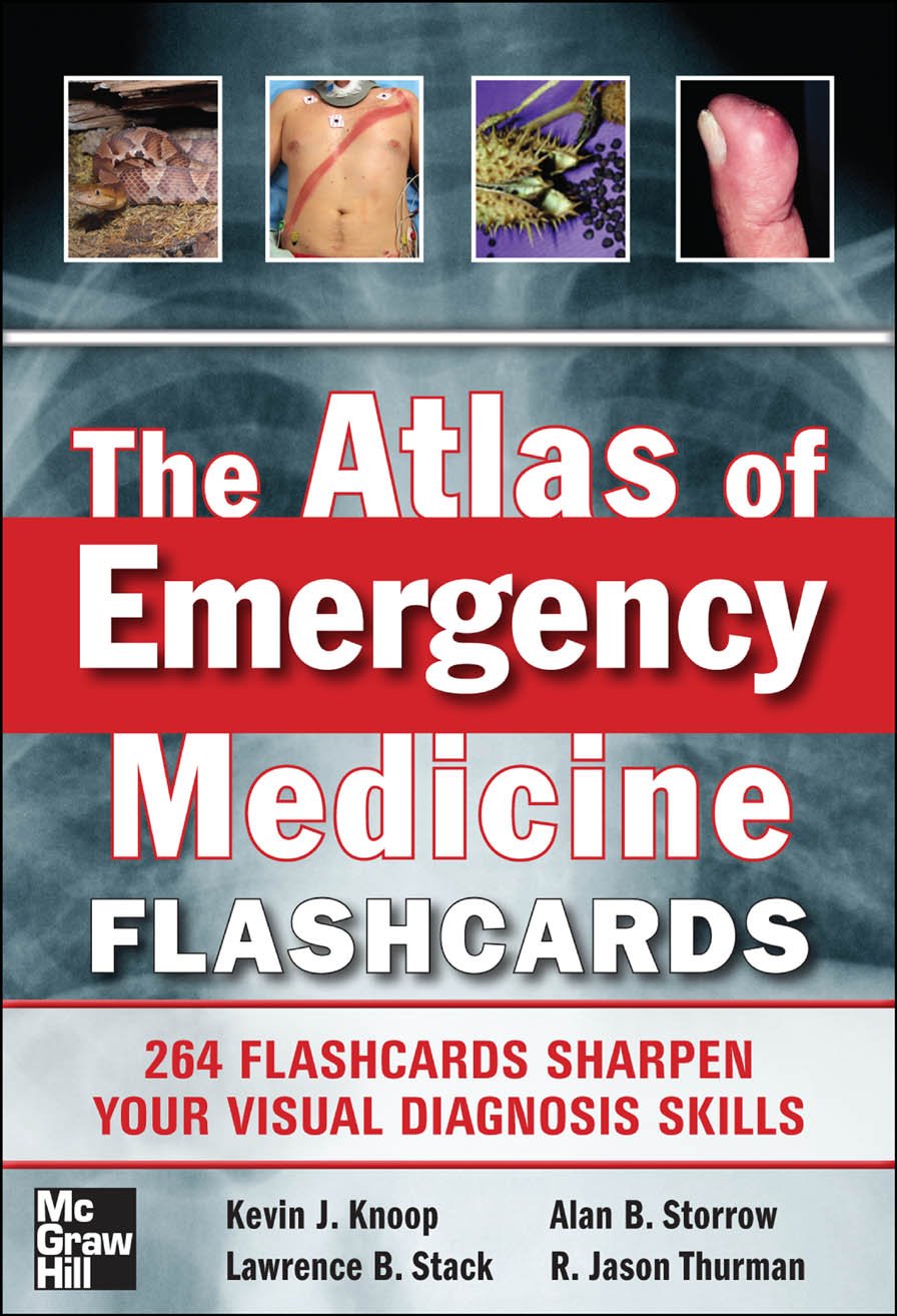The Atlas of Emergency Medicine Flashcards Premium Multicolor Matte Print Javed Books