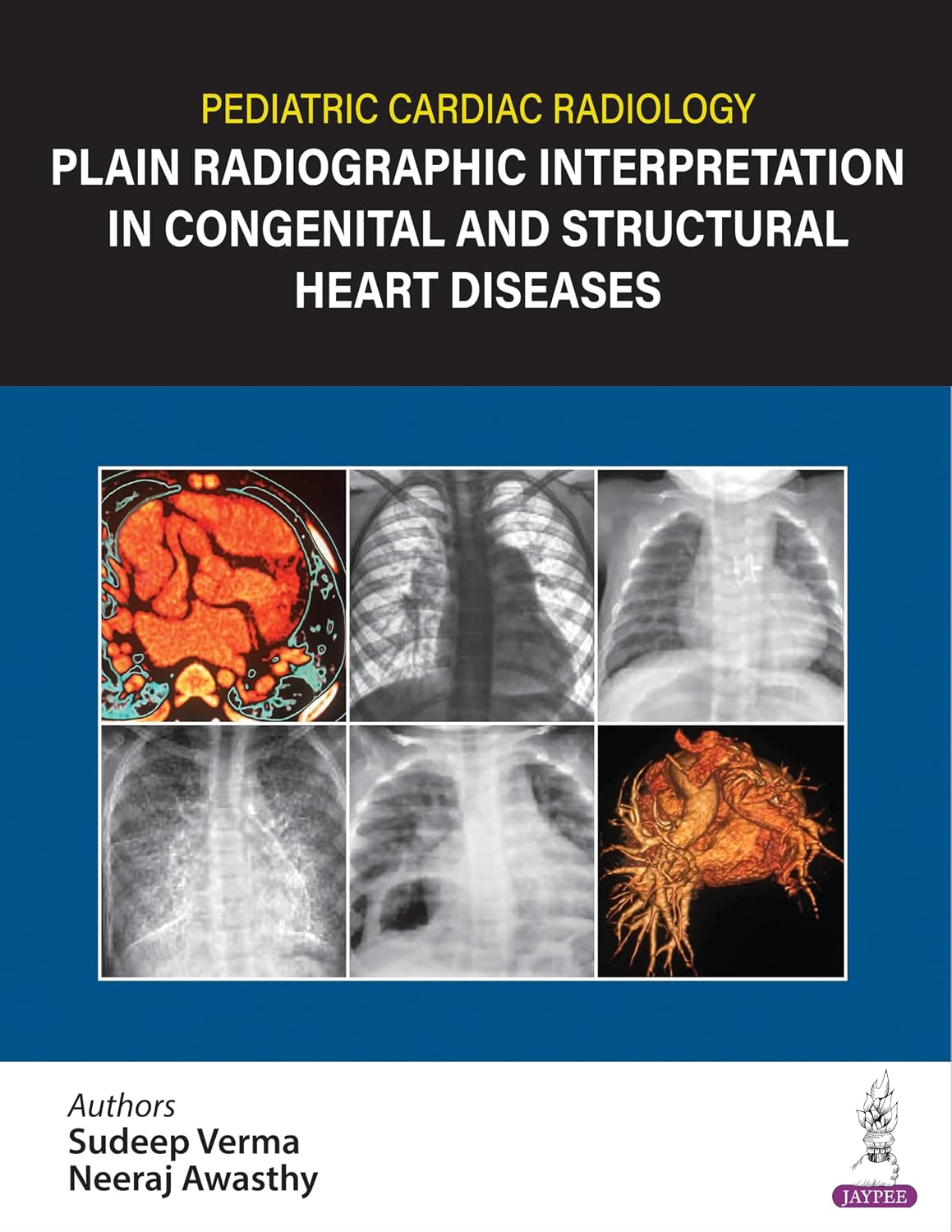 Pediatric Cardiac Radiology Premium Multicolor Matte Print Javed Books