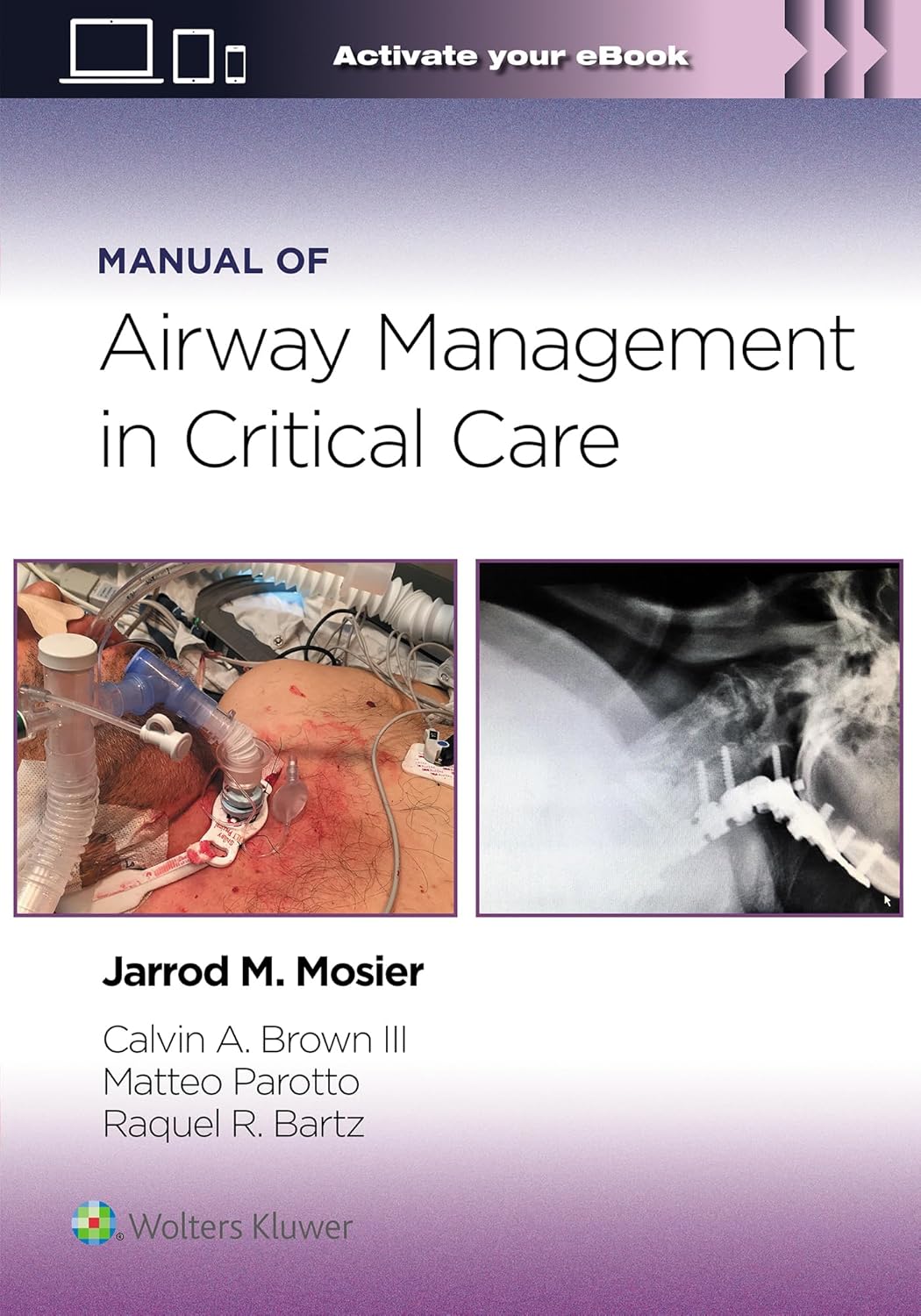 Manual of Airway Management in Critical Care 1st Edition Premium Multicolor Matte Print Javed Books