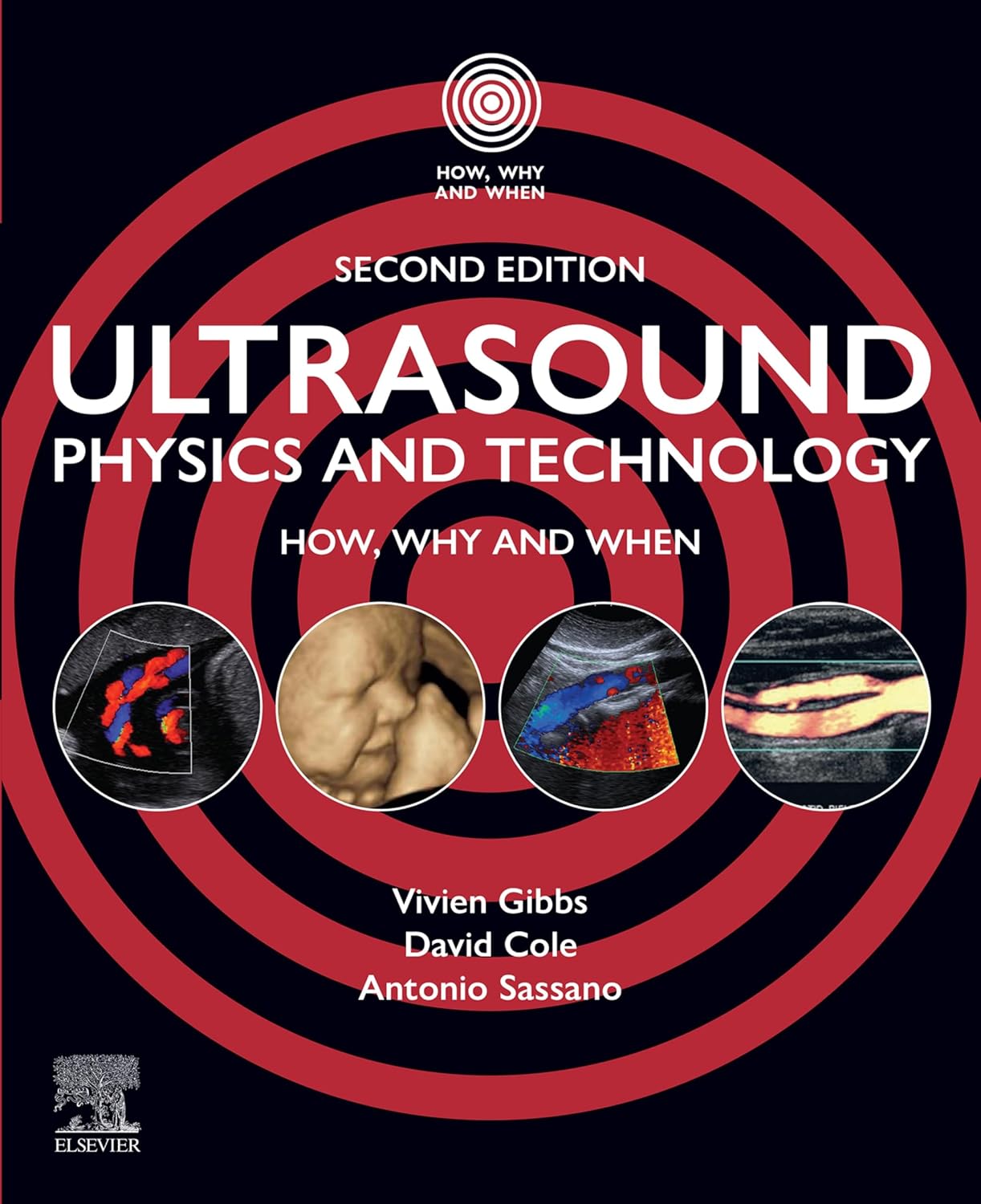 Ultrasound Physics and Technology How, Why and When 2025 2nd Edition Premium Multicolor Matte Print Javed Books