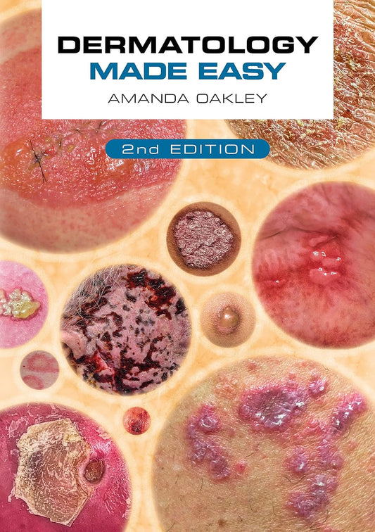 Dermatology Made Easy, Second Edition Premium Multicolour Mate Print