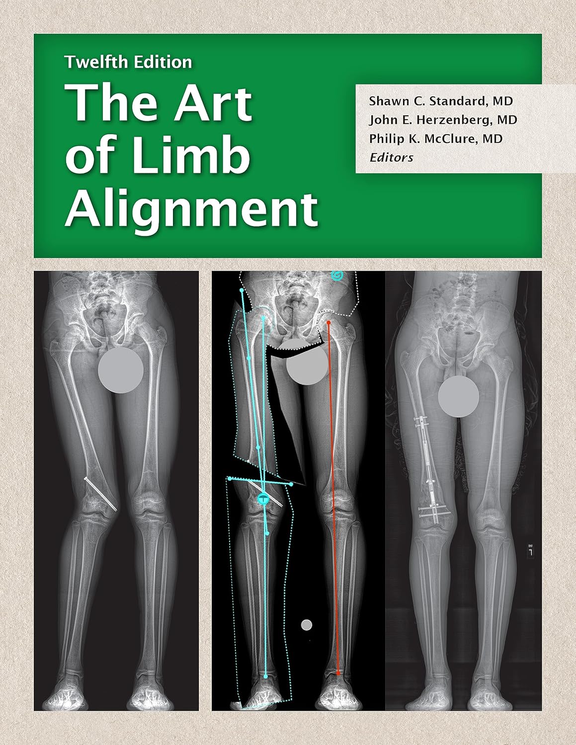 The Art of Limb Alignment 12th Edition Premium Multicolor Matte Print Javed Books
