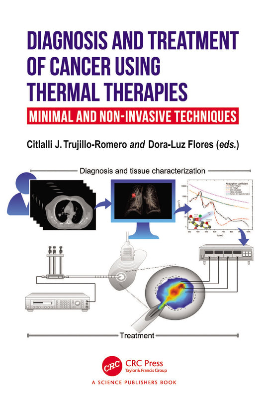Diagnosis and Treatment of Cancer using Thermal Therapies 2023