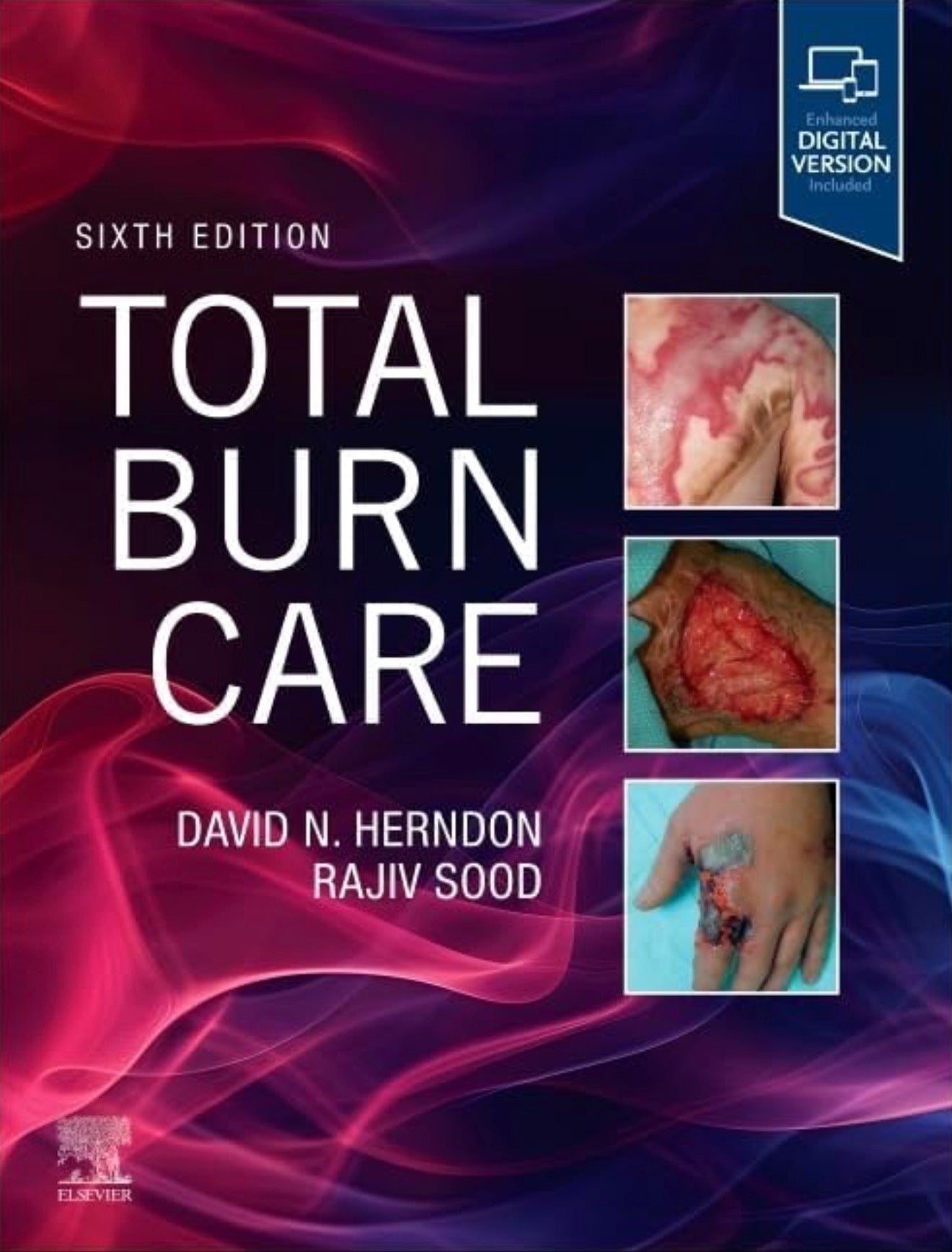 Total Burn Care 6th Edition 2026 Premium Multicolor Mate Print Javed Books