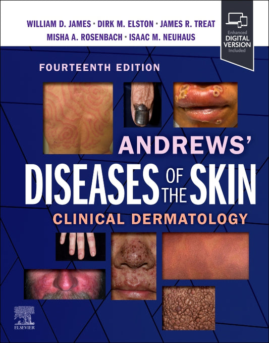 Andrews' Diseases of the Skin: Clinical Dermatology 14th Edition 2025 Premium Color Mate Print