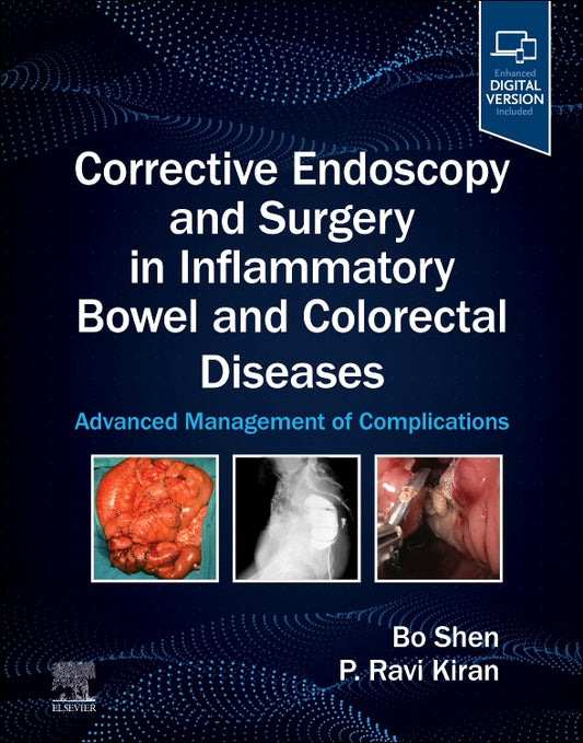 Corrective Endoscopy and Surgery in Inflammatory Bowel and Colorectal Diseases: Advanced Management of Complications 2025 Premium Color Mate Print