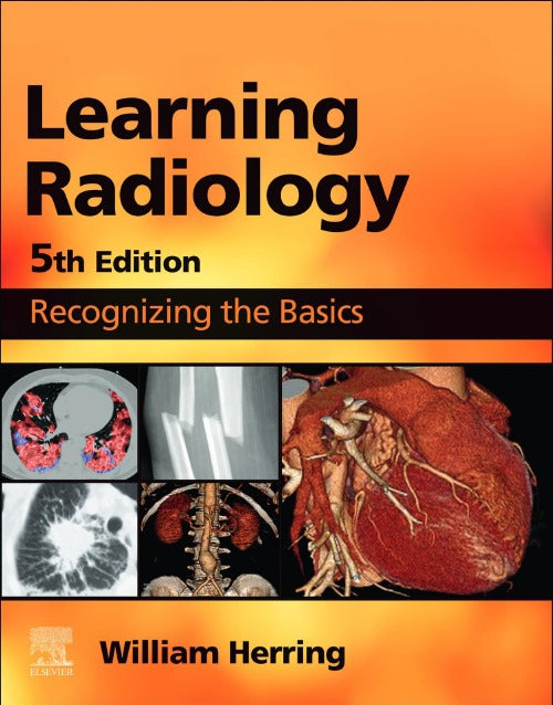 Learning Radiology: Recognizing the Basics 5th Edition 2023
