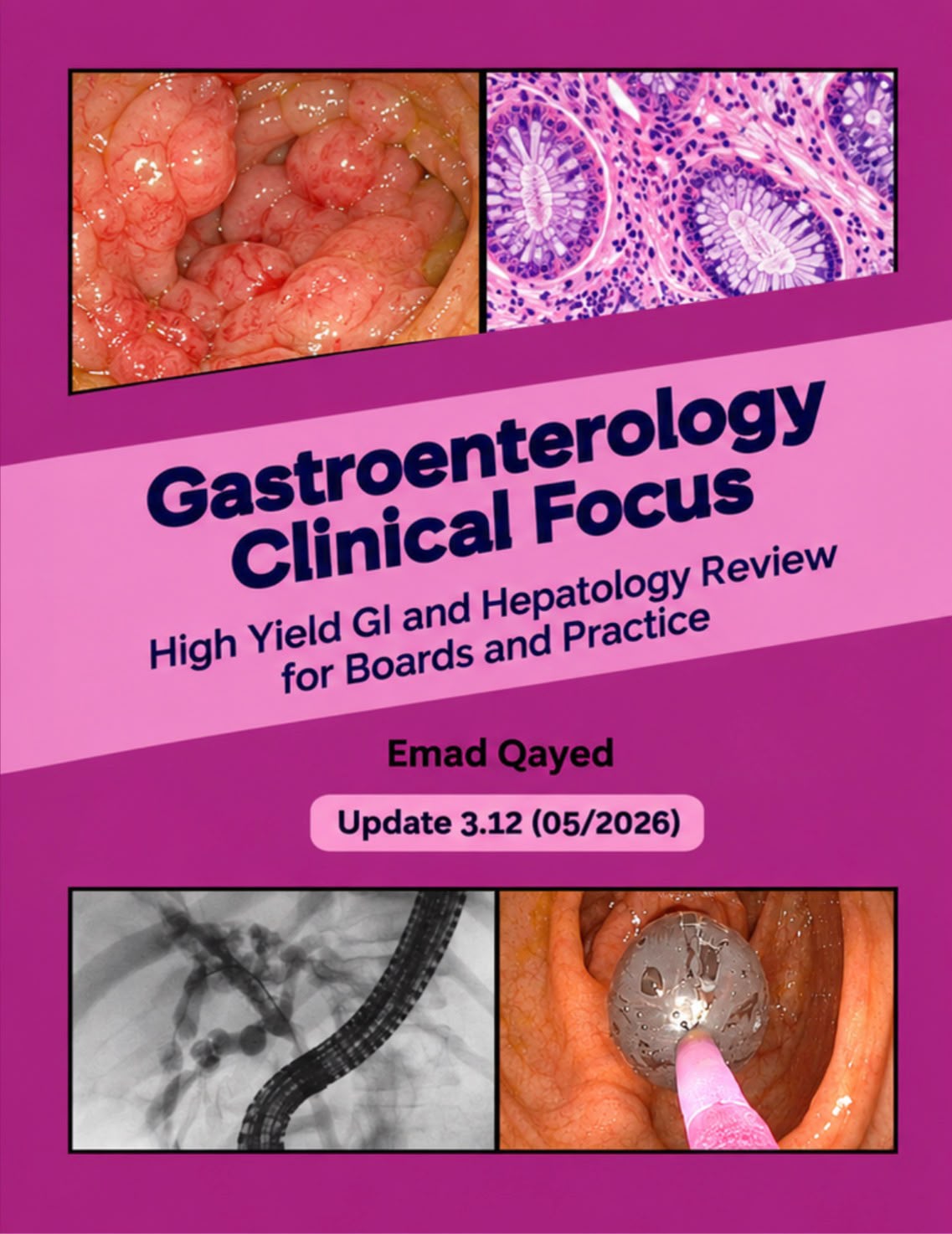 Gastroenterology Clinical Focus: High Yield GI and Hepatology Review – Emad Qayed (Update 3.12, 2026) Premium Multicolor Matt Print Javed Books