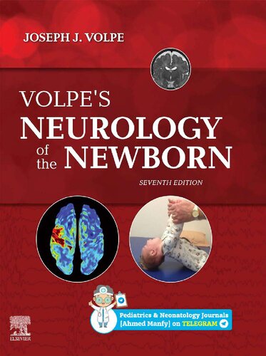 Volpe's Neurology of the Newborn 7th Edition