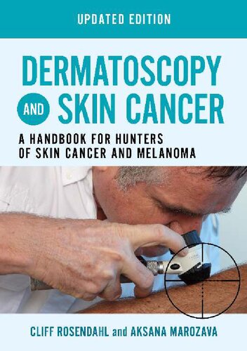 Dermatoscopy and Skin Cancer, updated edition: A handbook for hunters of skin cancer and melanoma 2023