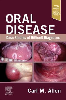 Oral Disease: Case Studies of Difficult Diagnoses by Carl M. Allen