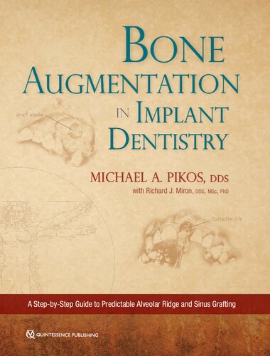 Bone Augmentation in Implant Dentistry: A Step-By-Step Guide to Predictable Alveolar Ridge and Sinus Grafting