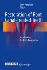 Restoration of Root Canal-Treated Teeth: An Adhesive Dentistry Perspective Javed Books