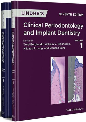 Lindhe's Clinical Periodontology and Implant Dentistry. Volume I-II