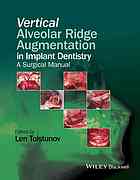 Vertical alveolar ridge augmentation in implant dentistry : a surgical manual Javed Books