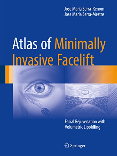 Atlas of Minimally Invasive Facelift: Facial Rejuvenation with Volumetric Lipofilling COLOR MATT PRINT