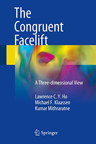 The Congruent Facelift: A Three-dimensional View COLOR MATT PRINT