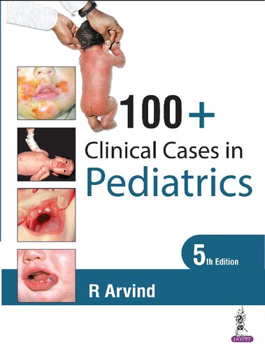 100+ Clinical Cases in Pediatrics