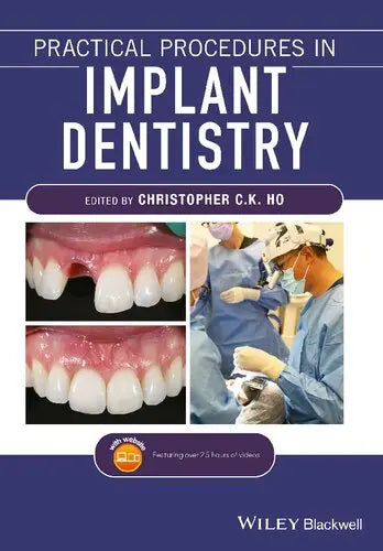 Practical Procedures in Implant Dentistry Javed Books