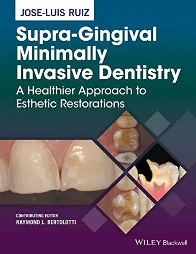 Supra-Gingival Minimally Invasive Dentistry: A Healthier Approach to Esthetic Restorations Javed Books