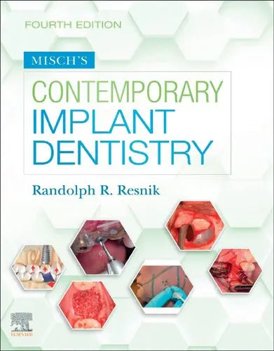 Misch's Contemporary Implant Dentistry Javed Books