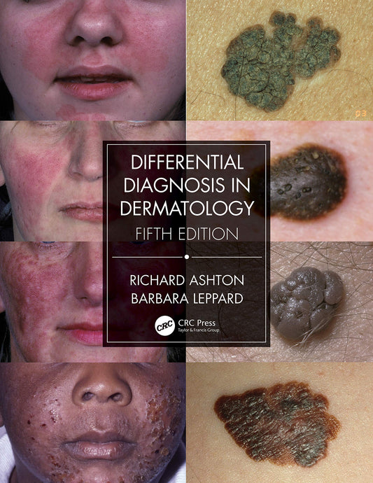 Differential Diagnosis in Dermatology COLOR MATT PRINT