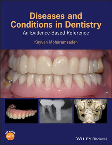 Diseases and conditions in dentistry : an evidence-based reference