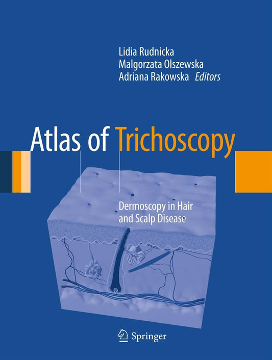 Atlas of Trichoscopy: Dermoscopy in Hair and Scalp Disease COLOR MATT PRINT