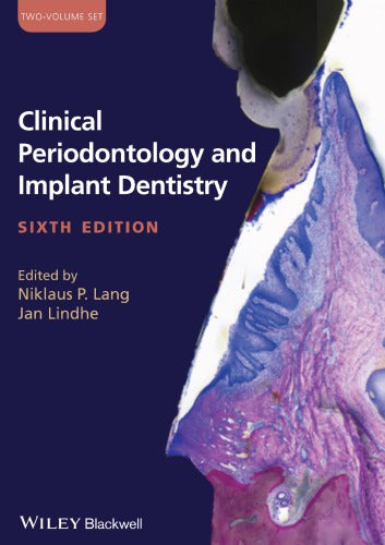 Clinical Periodontology and Implant Dentistry, 2 Volume Set
