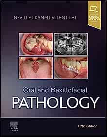 Neville Oral and Maxillofacial Pathology Color Matt Print