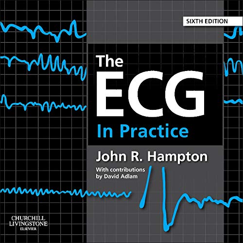 The ECG In Practice