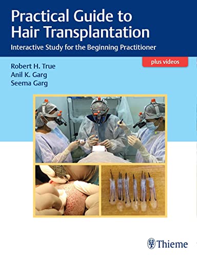 Practical Guide to Hair Transplantation: Interactive Study for the Beginning Practitioner COLOR MATT PRINT
